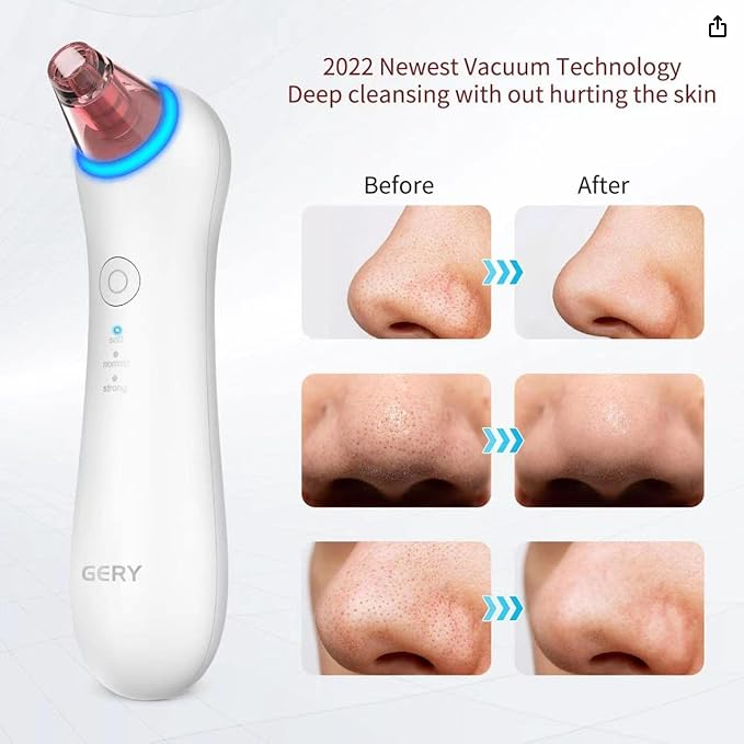 Limpiador Facial – Succionador de Puntos Negros