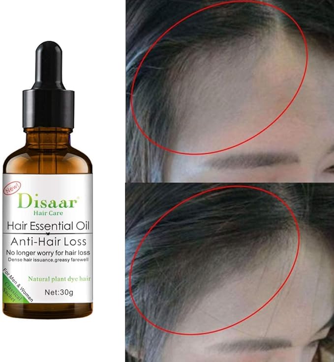 DISAAR ACEITE ESENCIAL - Tratamiento anticaída de cabello