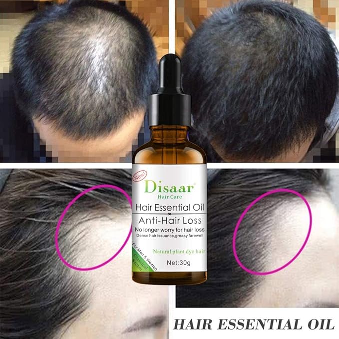 DISAAR ACEITE ESENCIAL - Tratamiento anticaída de cabello